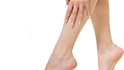 لا تتجاهلها.. خطوات قبل وبعد حقن دوالي الساقين