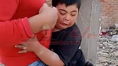 القصة الكاملة لقيام شابين بترهيب طفل من ذوى الإعاقة بكلب فى قليوب