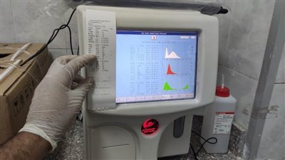 الإسكان: دعم مستشفى مدينة الشروق بجهاز 