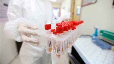 الصحة الفلسطينية: 204 إصابات بكورونا ترفع الحصيلة إلى 3689