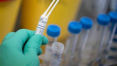 المغرب يسجل 136 إصابة جديدة بكورونا 