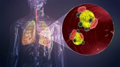 تحديد الأنواع الرئيسية لفيروس كورونا وأبرز الأعراض المصاحبة لها