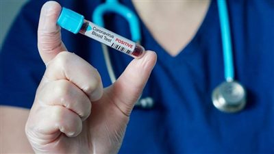 ألمانيا والصين تباشران في اختبار لقاح محتمل مشترك ضد كورونا