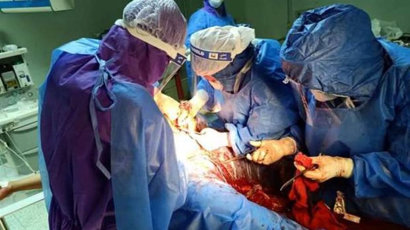 ولادة قيصرية