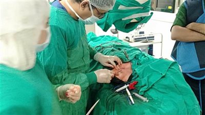 نجاح زراعة جهازين لتنظيم ضربات القلب لمسنين في بورسعيد