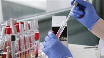 روسيا: إجراء أكثر من 35.7 مليون اختبار للكشف عن فيروس 