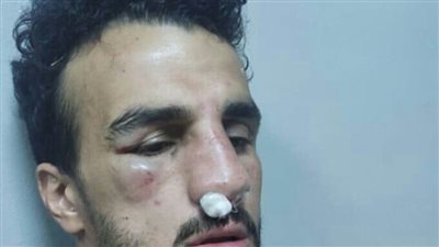 كسر في الأنف إصابة محمود رزق ومصيلحي يُتابع