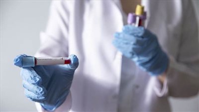 تعرّف على عدد الإصابات بـ