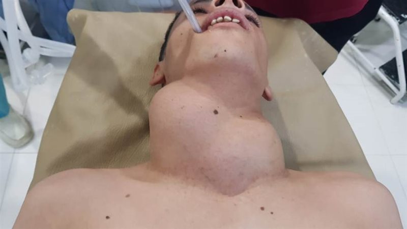 الشاب قبل العملية