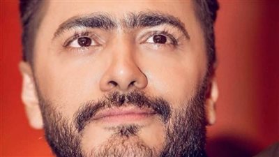 هل خضع تامر حسني لعملية تجميل؟ .. مصوره الخاص يجيب