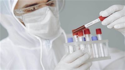 موسكو: تأكيد فعالية لقاح (سبوتنيك-v ستكون متاحة أوائل نوفمبر)