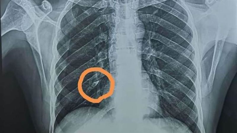 السنة كما تظهر بالأشعة