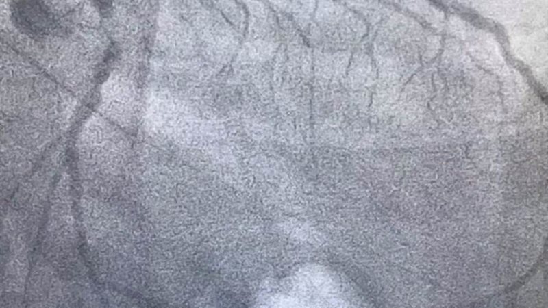 حالة المريض