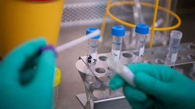 تسجيل 34 إصابة جديدة بـ