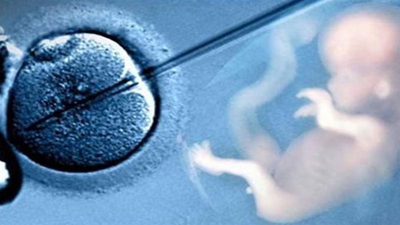 الحقن المجهري