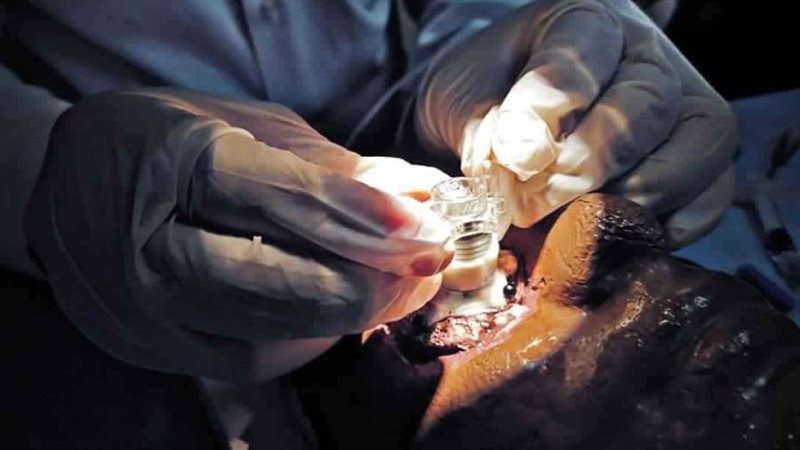 تدريب أطباء العيون