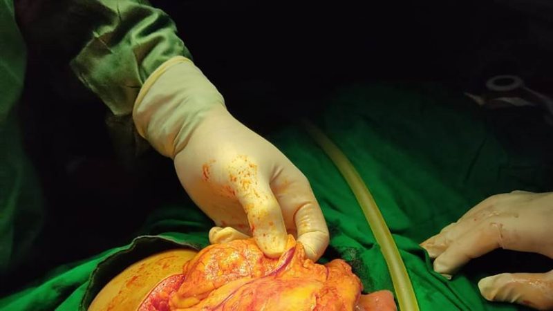 أثناء إجراء جراحة