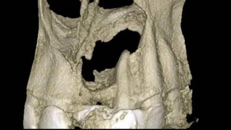 حالة المريض