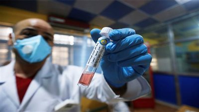 الصحة العالمية: المناعة المكتسبة من الاصابة بكورونا لا تمنع الإصابة مرة أخرى