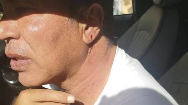 التعدي على أيمن يونس