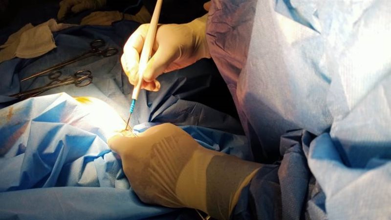 عملية جراحية