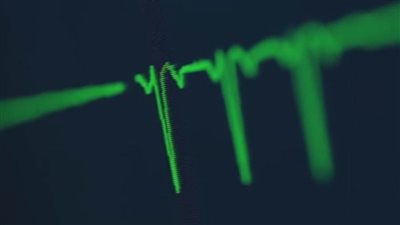   5 عائدين من الموت يروون تفاصيل الحياة في الآخرة.. (فيديو وصور)