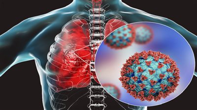 طبيبة: رئات المتعافين من 