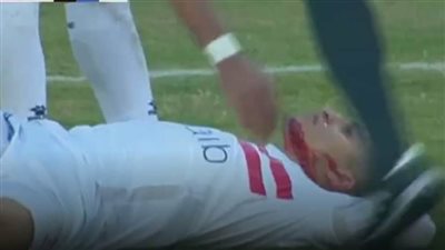 تبديل اضطراري بنزول 