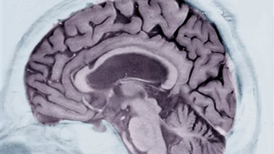   أعرف متي تصاب بمرض الزهايمر من طريقة كتابتك؟ 