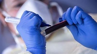 قبرص تسجل حالة وفاة و132 إصابة بفيروس 