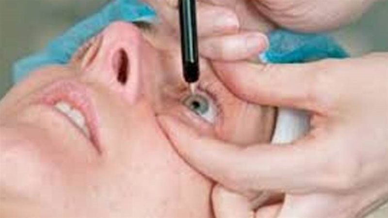 إبصار أبصار