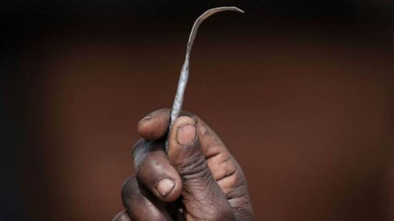 أدوات الختان