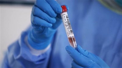  فلسطين تسجل 804 إصابات جديدة بفيروس كورونا