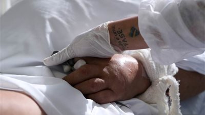 دراسة: البرازيل تواجه أخطر أزمة صحية في تاريخها