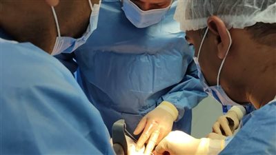 إجراء 3 عمليات جراحية لاستئصال أورام بالسعديين بالشرقية 