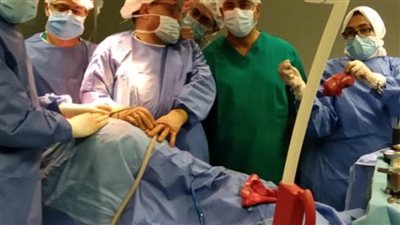 مستشفى عين شمس العام يجري جراحة استئصال كلي ناجحة في ظل كورونا