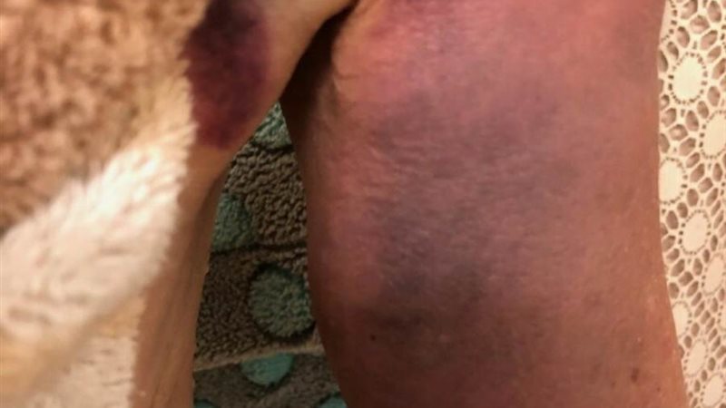 ذراع السيدة