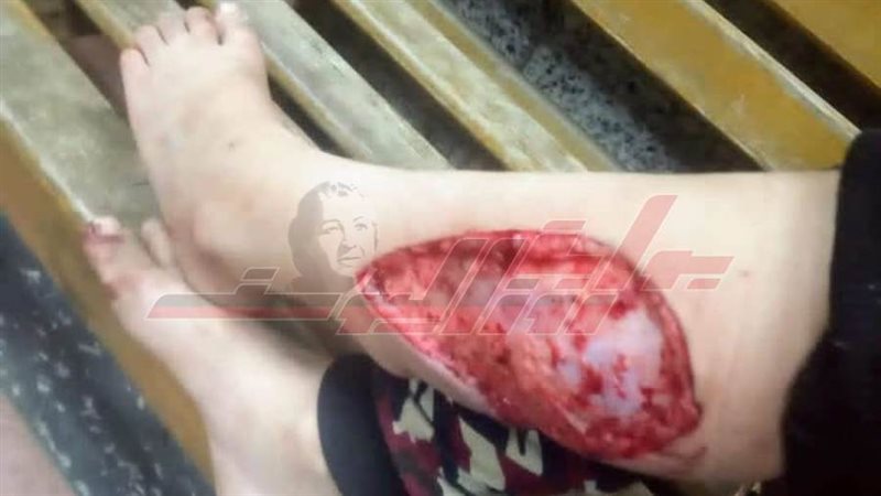 كلب يلتهم جزء من