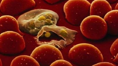 انجاز علمي: تطوير لقاح جديد للملاريا فعاليته 77 بالمئة