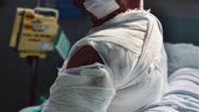 مؤسسة أهل مصر توقع بروتوكول تعاون مع جمعية الجورة لدعم ضحايا الحروق