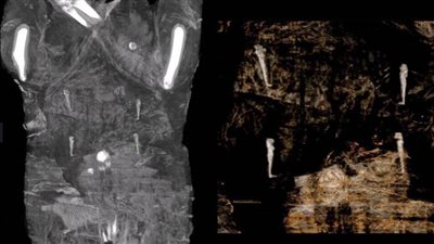 خبيرة مومياوات تشخص حالة المومياء الحامل وسبب تحنيطها 