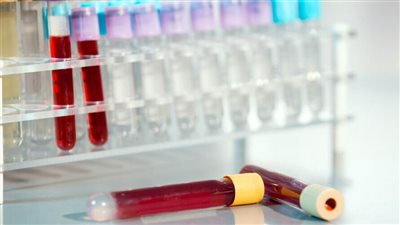 9 معلومات رائعة قد لا تعرفها عن الدم