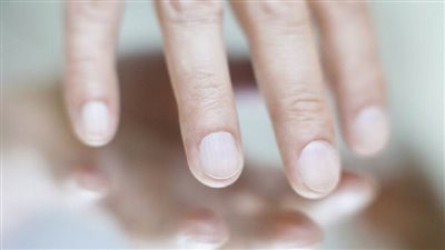 الألمان يبتكرون طريقة لكشف السرطان من حالة الأظافر