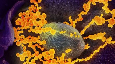 الصحة العالمية: قضية منشأ فيروس كورونا المستجد مسممة بالسياسة