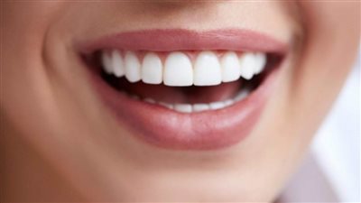 سحب الصبغات.. تعرف على فوائد تبييض الأسنان