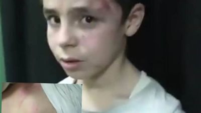 الأمن يكشف تفاصيل فيديو تضرر طفلين من والدهما وعمهما