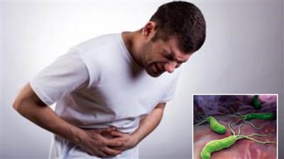 استشاري أمراض باطنة يوضح خطوات علاج جرثومة المعدة