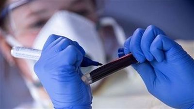 789 إصابة جديدة بكورونا في المغرب.. والحصيلة الإجمالية تتجاوز 532 ألفا