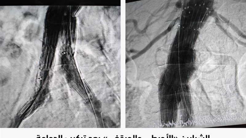 أشعة الجراحة