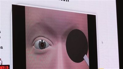 الرعاية الصحية تعلن تقديم 85 ألف خدمة طبية وعلاجية للمنتفعين خلال عام